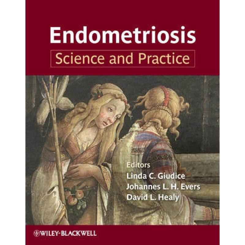 Endometriosis: Science and Practice
